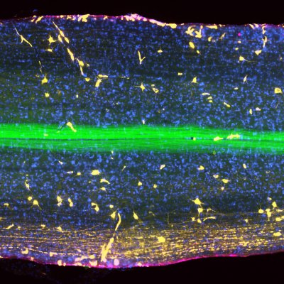 A slice through a spinal column showing the physical connection that links the brain to muscles.